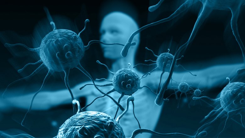 Bone marrow transplant and cancer immunotherapy