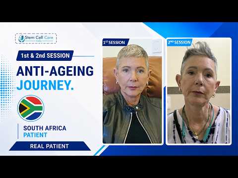 Before and after stem cell therapy for anti-ageing